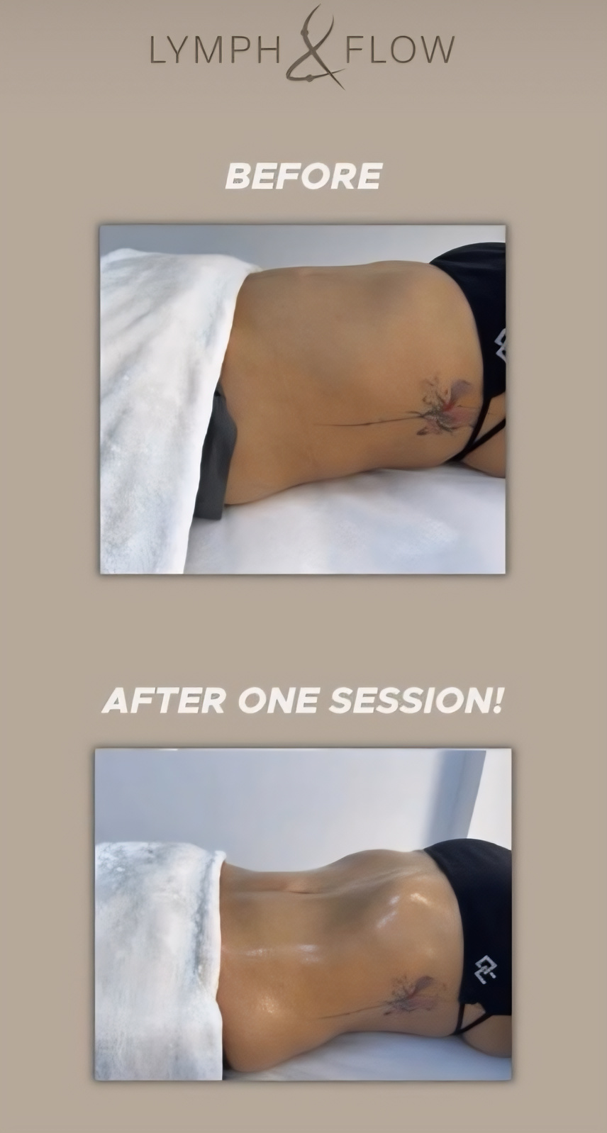Arms post-operative recovery